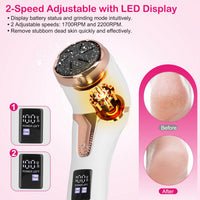 17Pcs Electric Foot Callus Remover With Vacuum Foot Grinder Rechargeable Foot File Dead Skin Pedicure Machine With 3 Grinding Heads 2 Speeds Foot Care Tool 4